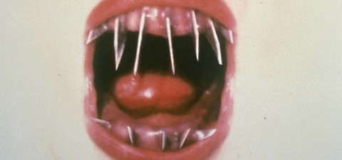The Dentist 2 - Zahnarzt des Schreckens