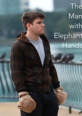 The Man With Elephant Hands
