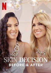 Skin Decision: Before and After